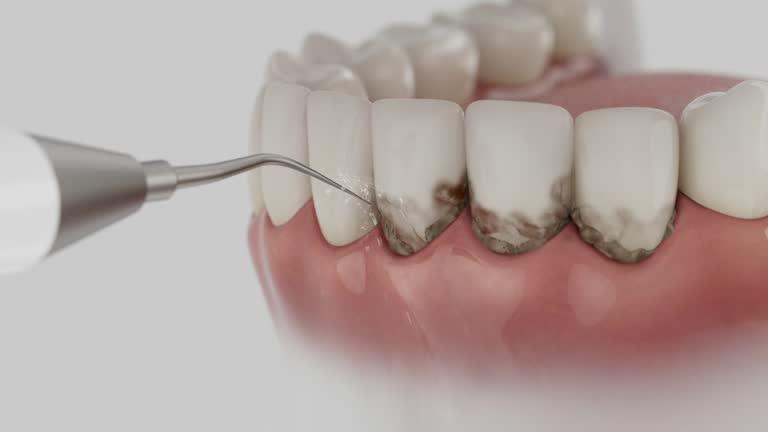 Trusted Root Canal Treatment service in Marmet, WV - Dentist Open Now
